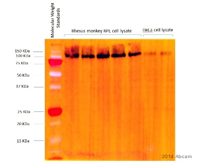Western blot - Anti-LAMP2 antibody [H4B4] - Lysosome Marker (ab25631), expandable thumbnail