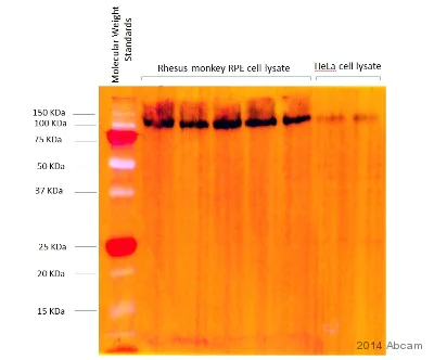 Western blot - Anti-LAMP2 antibody [H4B4] - Lysosome Marker (AB25631)