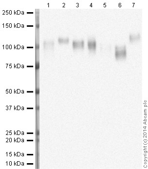 Western blot - Anti-LAMP2 antibody [H4B4] - Lysosome Marker (AB25631), expandable thumbnail