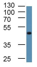 Western blot - Anti-LAMP2 antibody - Lysosome Marker (AB203224), expandable thumbnail