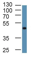 Western blot - Anti-LAMP2 antibody - Lysosome Marker (AB203224)