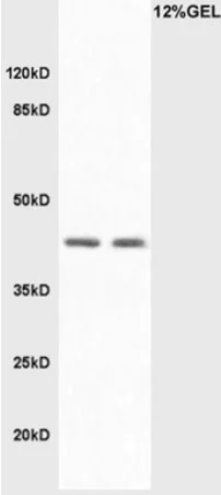 Western blot - Anti-LAMP2 antibody - Lysosome Marker (AB203224)