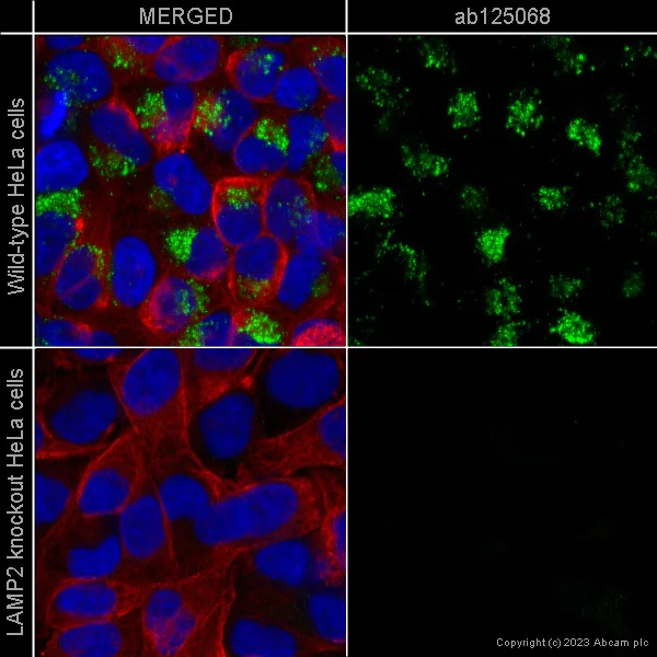 Immunocytochemistry/ Immunofluorescence - Anti-LAMP2A antibody [EPR4207(2)] - BSA and Azide free (AB240018)
