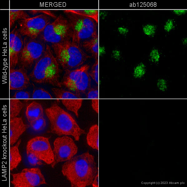 Immunocytochemistry/ Immunofluorescence - Anti-LAMP2A antibody [EPR4207(2)] - BSA and Azide free (AB240018)