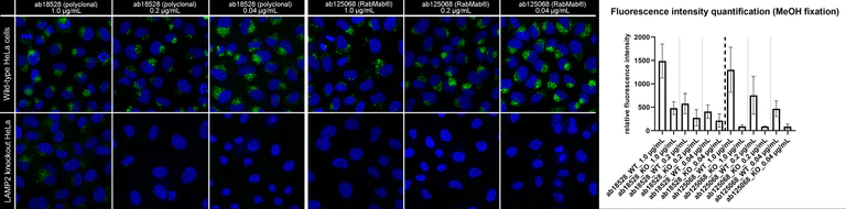 Immunocytochemistry/ Immunofluorescence - Anti-LAMP2A antibody [EPR4207(2)] - BSA and Azide free (AB240018)