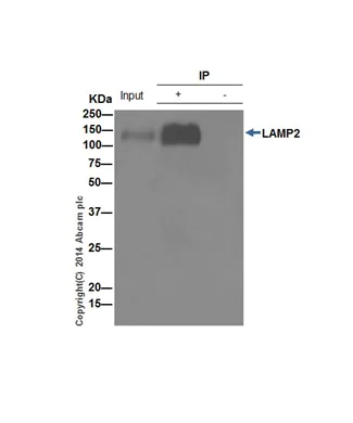 Immunoprecipitation - Anti-LAMP2A antibody [EPR4207(2)] - BSA and Azide free (AB240018)