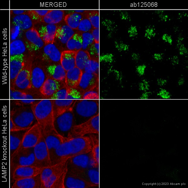 Immunocytochemistry/ Immunofluorescence - Anti-LAMP2A antibody [EPR4207(2)] - Lysosome Marker (ab125068), expandable thumbnail