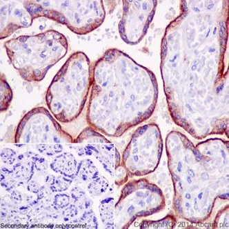 Immunohistochemistry (Formalin/PFA-fixed paraffin-embedded sections) - Anti-LAMP2A antibody [EPR4207(2)] - Lysosome Marker (AB125068)