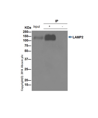 Immunoprecipitation - Anti-LAMP2A antibody [EPR4207(2)] - Lysosome Marker (AB125068), expandable thumbnail