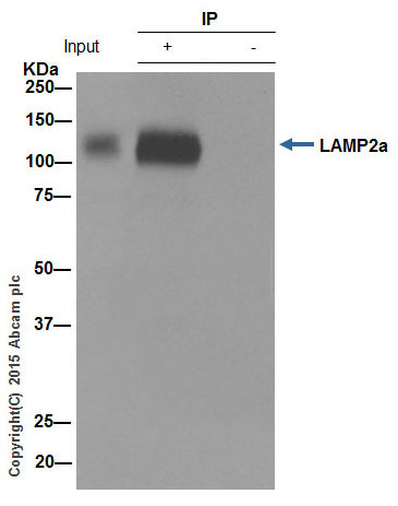 Immunoprecipitation - Anti-LAMP2A antibody [EPR4207(2)] - Lysosome Marker (AB125068), expandable thumbnail