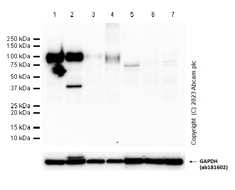 Western blot - Anti-LAMP2A antibody [EPR4207(2)] - Lysosome Marker (ab125068), expandable thumbnail