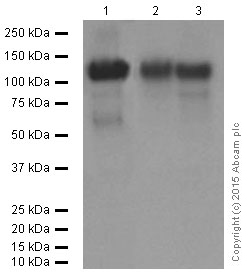 Western blot - Anti-LAMP2A antibody [EPR4207(2)] - Lysosome Marker (ab125068), expandable thumbnail