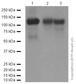 Western blot - Anti-LAMP2A antibody [EPR4207(2)] - Lysosome Marker (AB125068)