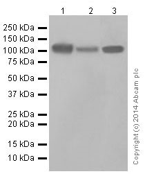 Western blot - Anti-LAMP2A antibody [EPR4207(2)] - Lysosome Marker (ab125068), expandable thumbnail