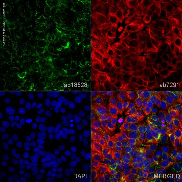 Immunocytochemistry/ Immunofluorescence - Anti-LAMP2A antibody - Lysosome Marker (AB18528)