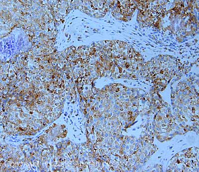 Immunohistochemistry (Formalin/PFA-fixed paraffin-embedded sections) - Anti-LAMP2A antibody - Lysosome Marker (AB18528), expandable thumbnail