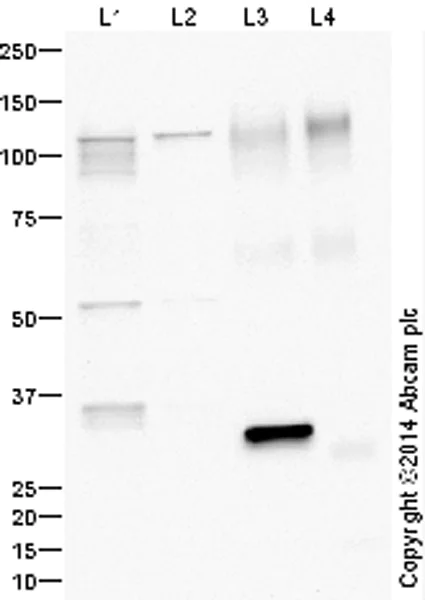Western blot - Anti-LAMP2A antibody - Lysosome Marker (AB18528)