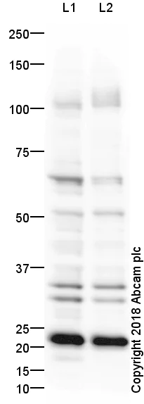 Western blot - Anti-LAMP2B antibody - Lysosome Marker (AB18529)