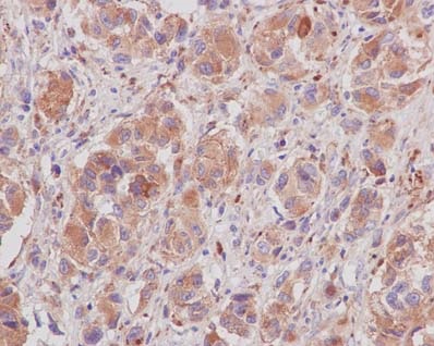 Immunohistochemistry (Formalin/PFA-fixed paraffin-embedded sections) - Anti-LAMTOR2 antibody [EPR14378] (AB183514)