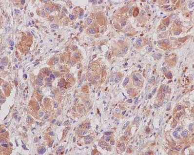 Immunohistochemistry (Formalin/PFA-fixed paraffin-embedded sections) - Anti-LAMTOR2 antibody [EPR14378] (AB183514)
