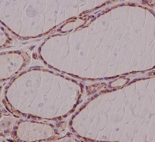 Immunohistochemistry (Formalin/PFA-fixed paraffin-embedded sections) - Anti-LAMTOR2 antibody [EPR14378] (AB183514)