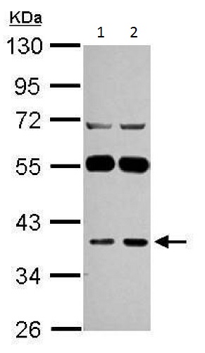 Western blot - Anti-LANCL1 antibody (AB229257), expandable thumbnail
