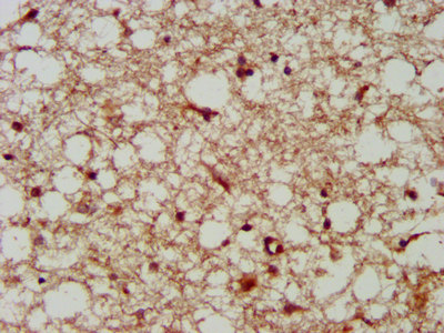Immunohistochemistry (Formalin/PFA-fixed paraffin-embedded sections) - Anti-LANCL2 antibody (AB237520), expandable thumbnail