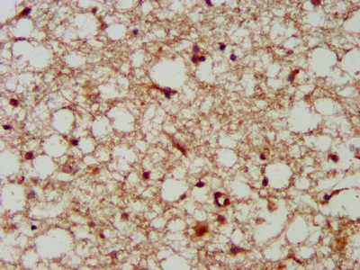 Immunohistochemistry (Formalin/PFA-fixed paraffin-embedded sections) - Anti-LANCL2 antibody (AB237520)