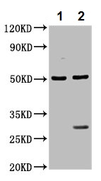Western blot - Anti-LANCL2 antibody (AB237520), expandable thumbnail