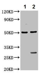 Western blot - Anti-LANCL2 antibody (AB237520)