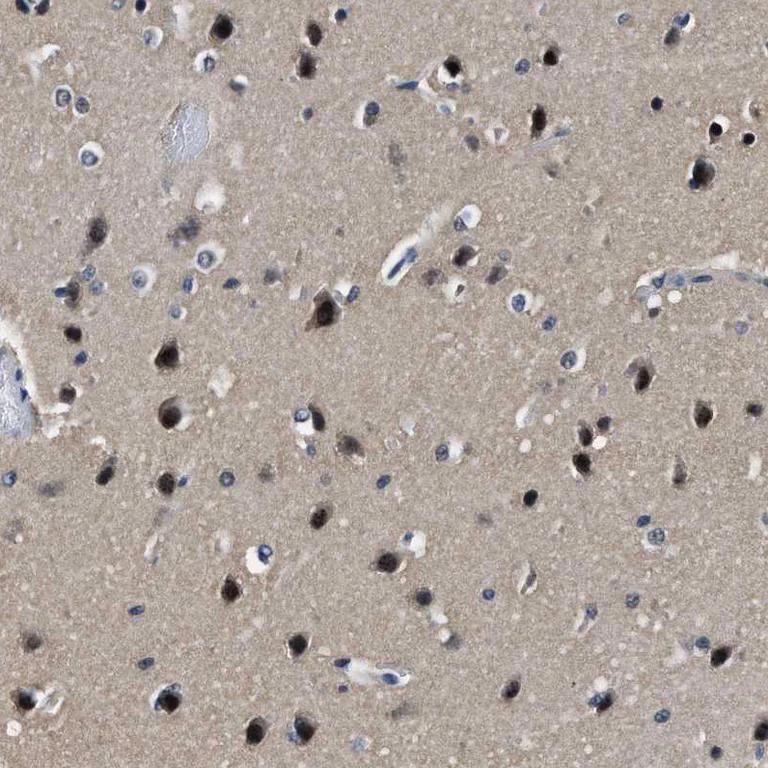 Immunohistochemistry (Formalin/PFA-fixed paraffin-embedded sections) - Anti-LANCL2 antibody (AB272583)