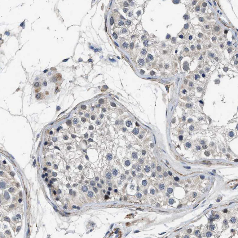 Immunohistochemistry (Formalin/PFA-fixed paraffin-embedded sections) - Anti-LANCL2 antibody (AB272583)