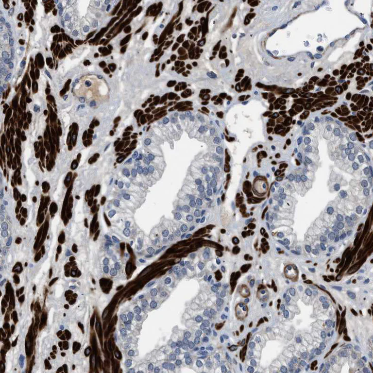 Immunohistochemistry (Formalin/PFA-fixed paraffin-embedded sections) - Anti-LANCL2 antibody (AB272583)
