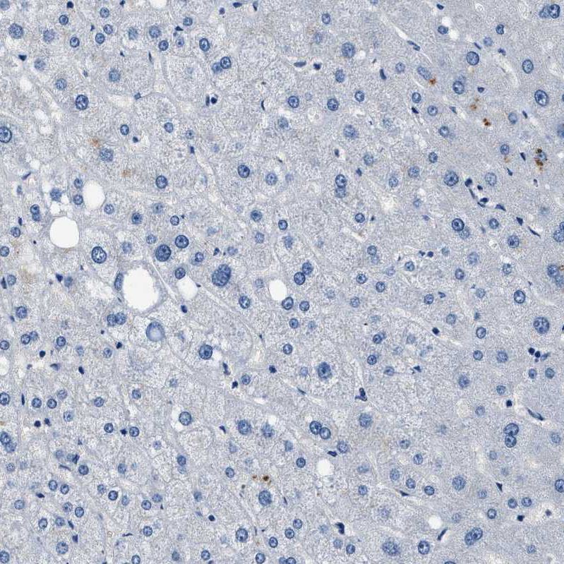 Immunohistochemistry (Formalin/PFA-fixed paraffin-embedded sections) - Anti-LANCL2 antibody (AB272583)