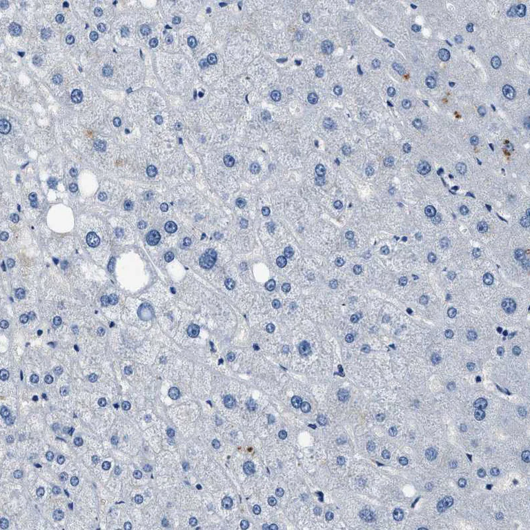 Immunohistochemistry (Formalin/PFA-fixed paraffin-embedded sections) - Anti-LANCL2 antibody (AB272583)