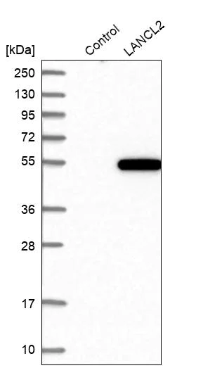 Western blot - Anti-LANCL2 antibody (AB272583)