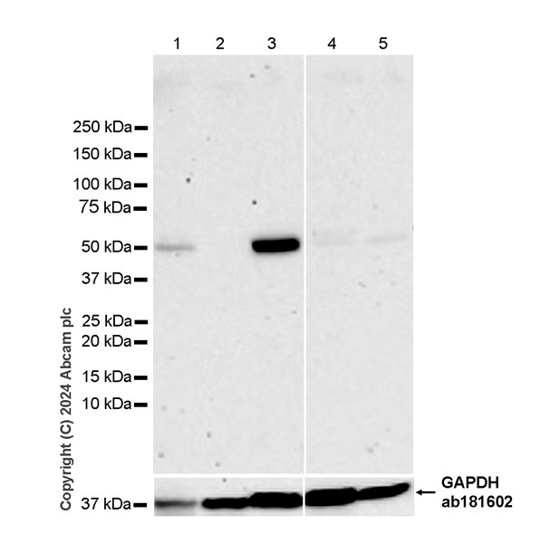 Western blot - Anti-LANCL2 antibody [EPR27973-132] - BSA and Azide free (AB317445), expandable thumbnail