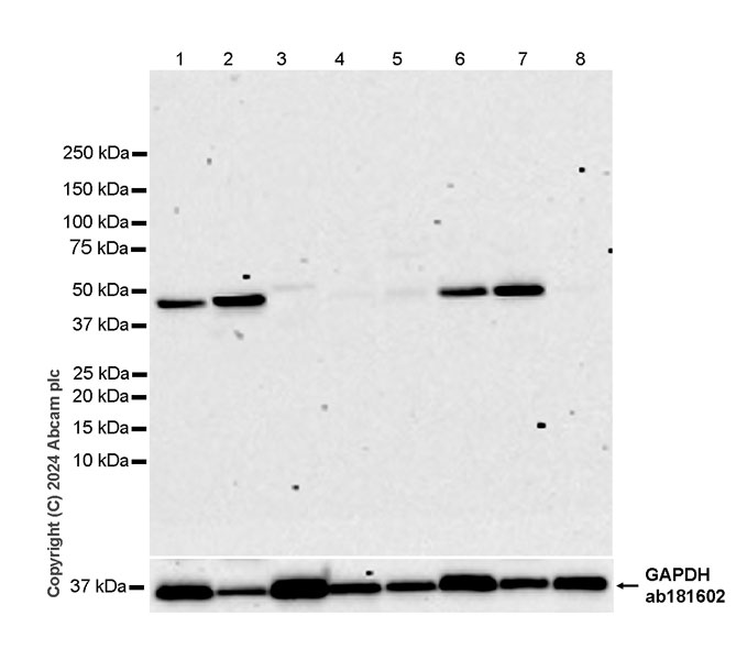 Western blot - Anti-LANCL2 antibody [EPR27973-132] - BSA and Azide free (AB317445), expandable thumbnail