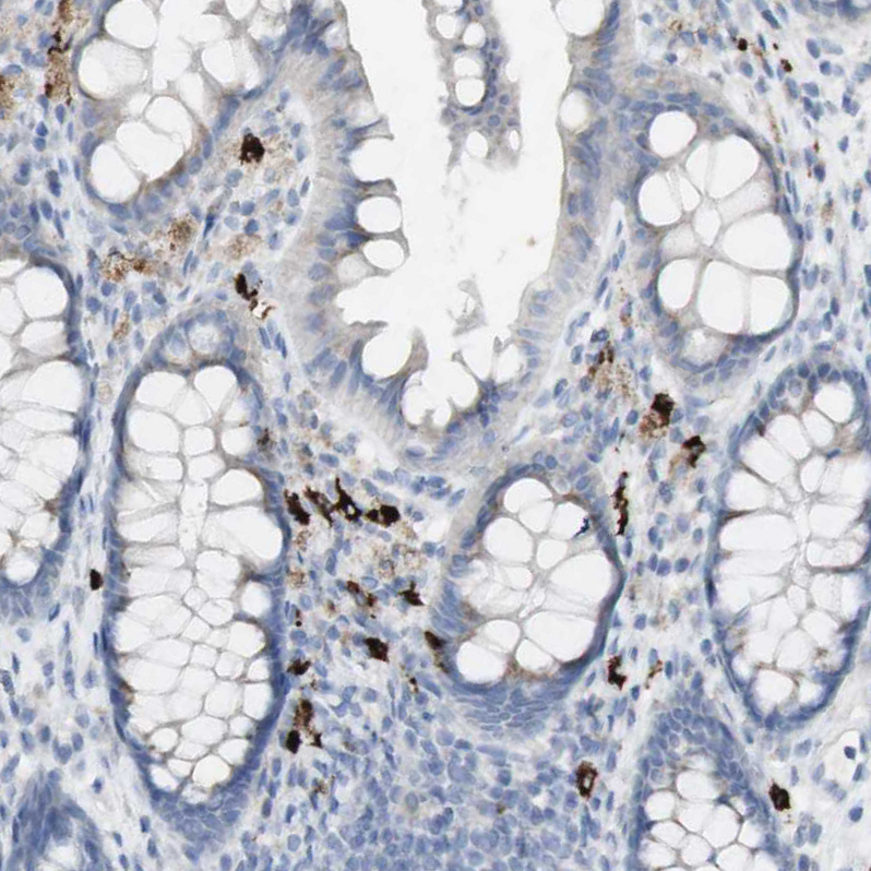 Immunohistochemistry (Formalin/PFA-fixed paraffin-embedded sections) - Anti-Langerin antibody (AB244322), expandable thumbnail