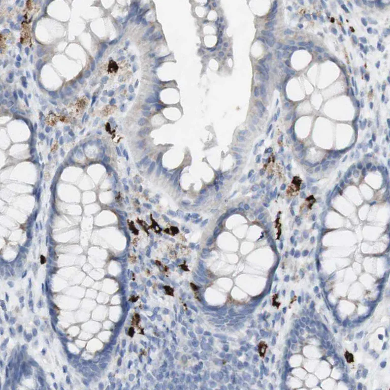 Immunohistochemistry (Formalin/PFA-fixed paraffin-embedded sections) - Anti-Langerin antibody (AB244322)