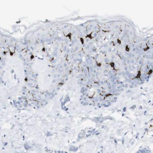 Immunohistochemistry (Formalin/PFA-fixed paraffin-embedded sections) - Anti-Langerin antibody (AB244322), expandable thumbnail