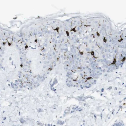 Immunohistochemistry (Formalin/PFA-fixed paraffin-embedded sections) - Anti-Langerin antibody (AB244322)