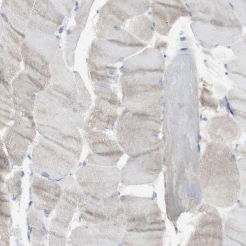 Immunohistochemistry (Formalin/PFA-fixed paraffin-embedded sections) - Anti-Langerin antibody (AB244322), expandable thumbnail
