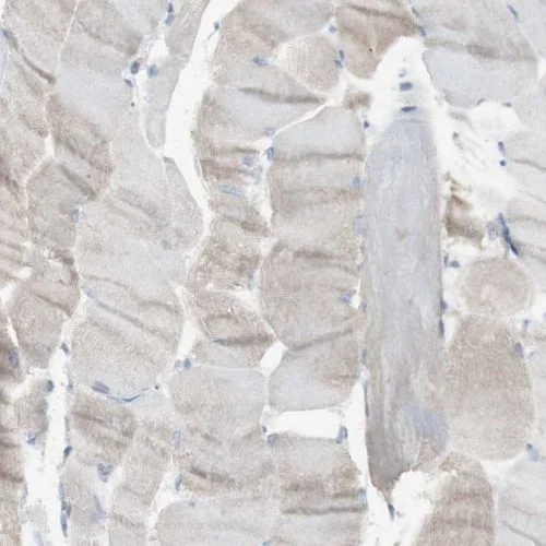 Immunohistochemistry (Formalin/PFA-fixed paraffin-embedded sections) - Anti-Langerin antibody (AB244322)