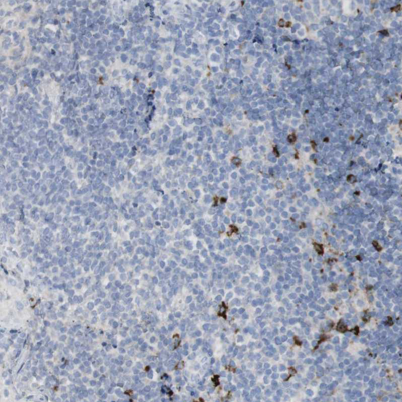 Immunohistochemistry (Formalin/PFA-fixed paraffin-embedded sections) - Anti-Langerin antibody (AB244322), expandable thumbnail