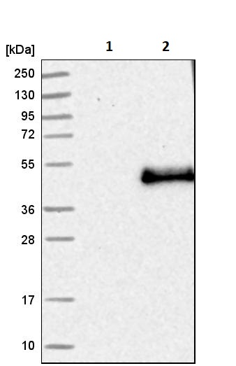 Western blot - Anti-Langerin antibody (AB244322), expandable thumbnail