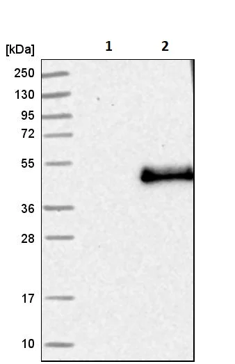 Western blot - Anti-Langerin antibody (AB244322)