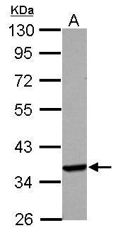 Western blot - Anti-Langerin antibody (AB272895), expandable thumbnail
