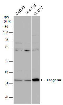 Western blot - Anti-Langerin antibody (AB272895), expandable thumbnail