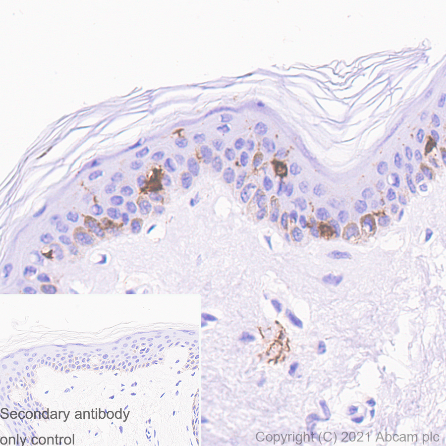 Immunohistochemistry (Formalin/PFA-fixed paraffin-embedded sections) - Anti-Langerin antibody [EPR15863] - BSA and Azide free (AB232603), expandable thumbnail